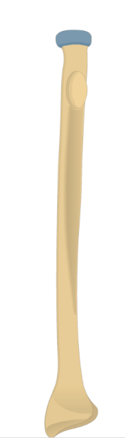 <p>What part of the radius is this?</p>