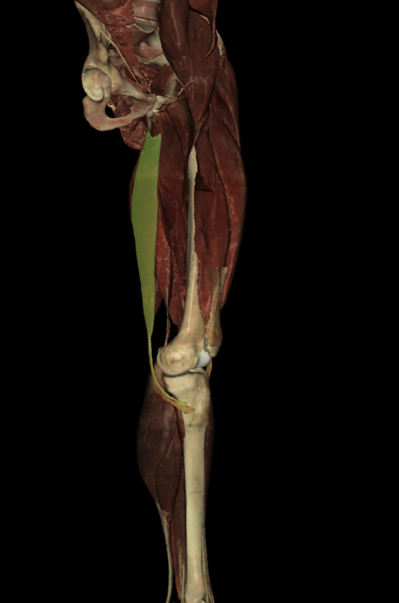 <p>Identify the Structure</p>