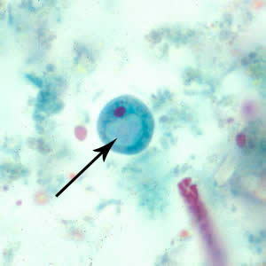 <ul><li><p>6-15 um</p></li><li><p>prominent glycogen vacuole</p></li><li><p>vacuolated cytoplasm</p></li><li><p>ONLY amoebic cyst with ONE nucleus</p></li></ul><p></p>
