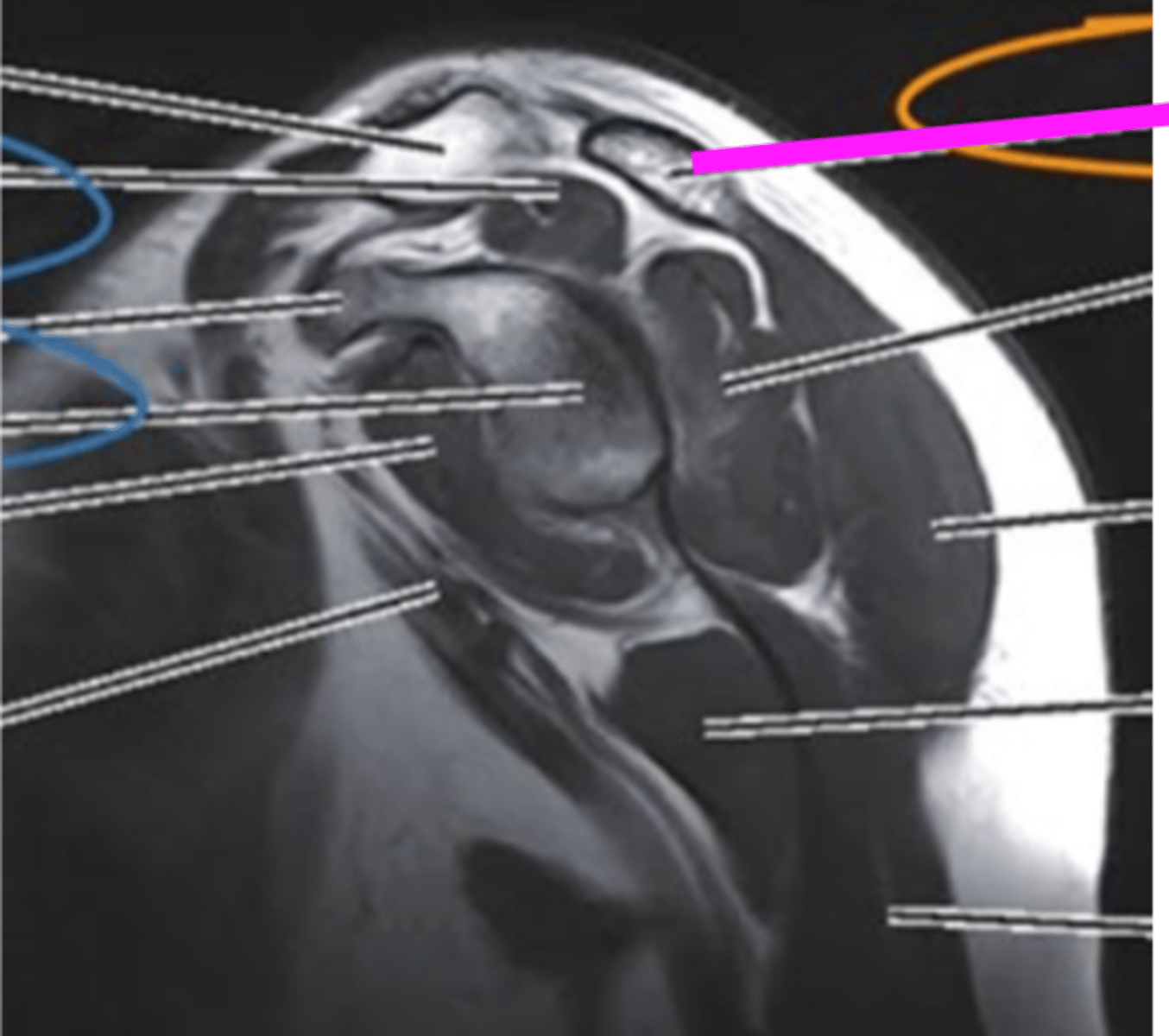 <p>what does the pink line point to?</p>