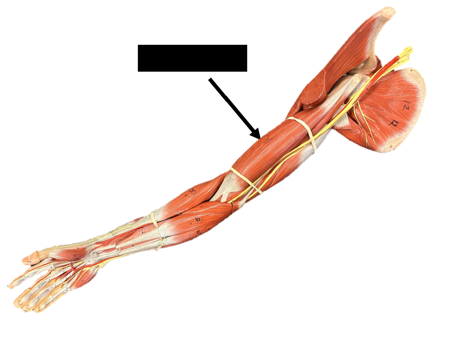 <p>Origin: coracoid process of scapula</p><p>Insertion: radial tuberosity</p><p>Function: flexes forearm at the elbow joint</p>