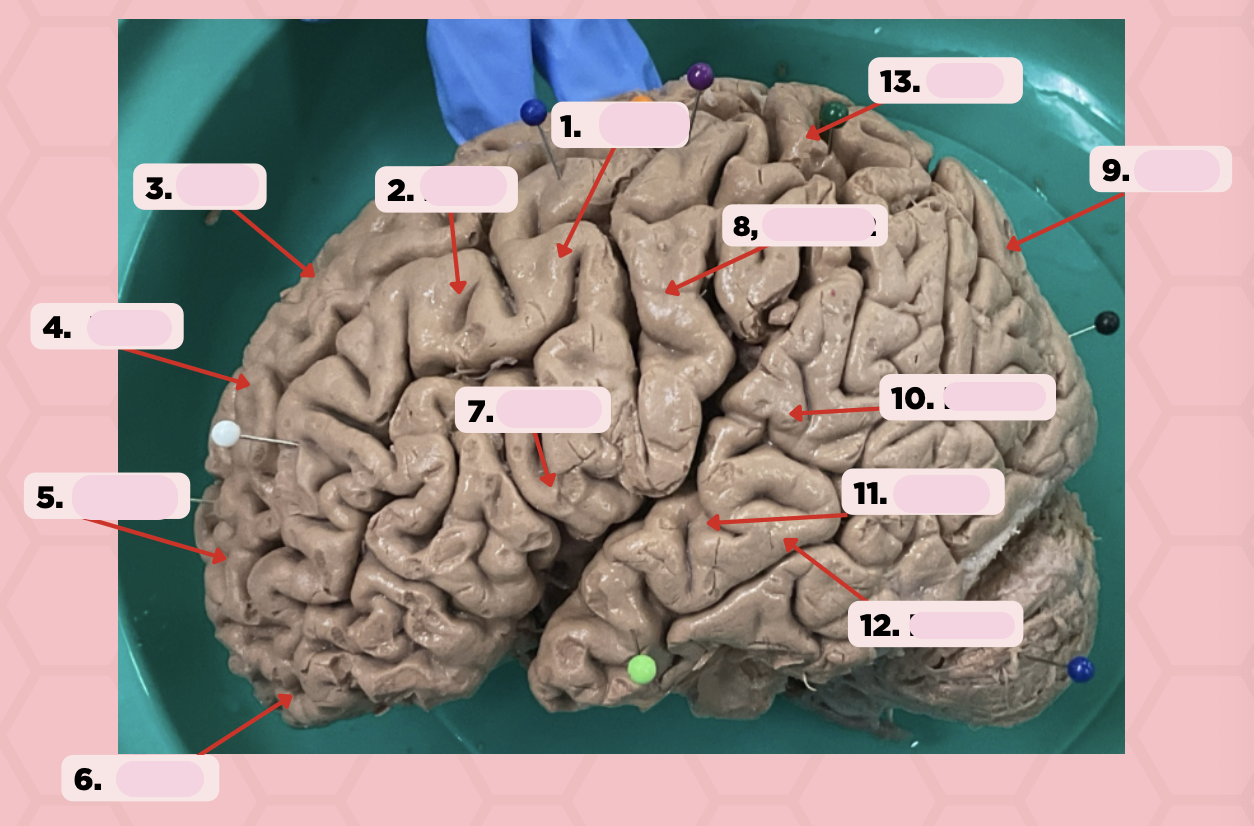 <p>Identify the structure labeled as 1.</p>