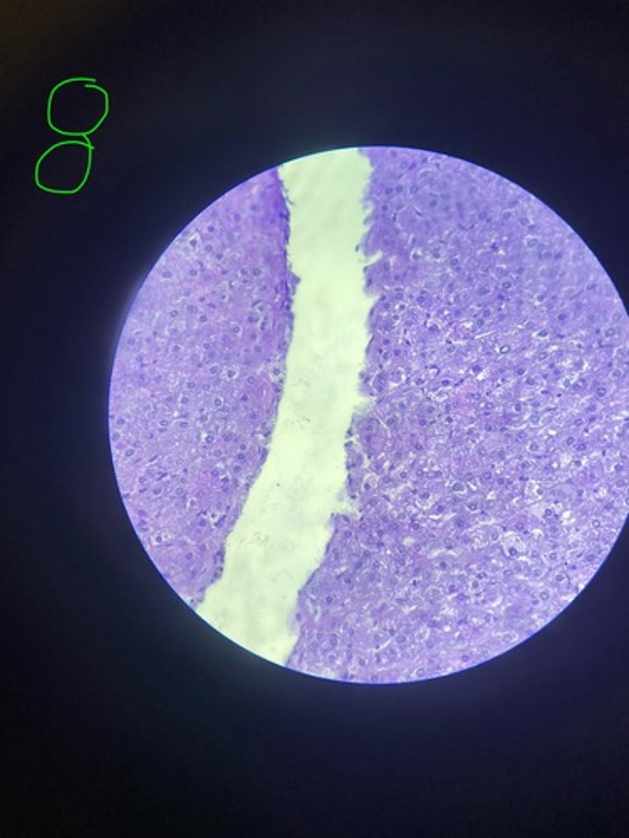 <p>What stain is this?</p>