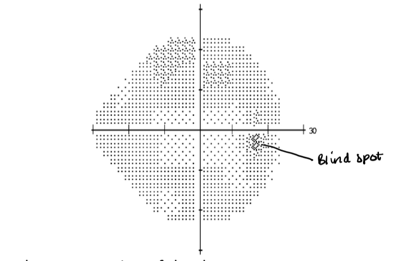 <p>What is this VF plot called</p>