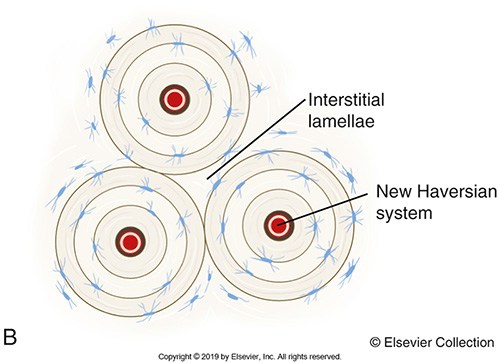 <p><span>The area between the Haversian Systems is known as the </span><strong>Interstitial Lamellae. </strong><span>It also has entrapped bone cells and layers. The Interstitial lamellae are old Haversian System parts that were destroyed and replaced with new systems.</span></p>