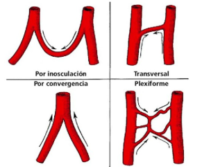 <p>Cuando una arteria converge con otra y ocurre una inosculación o convergencia.</p>