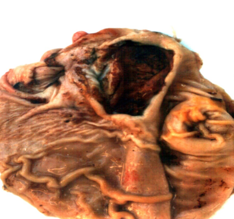 term image