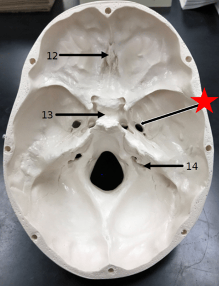 <p>Name the starred region in the image.</p>