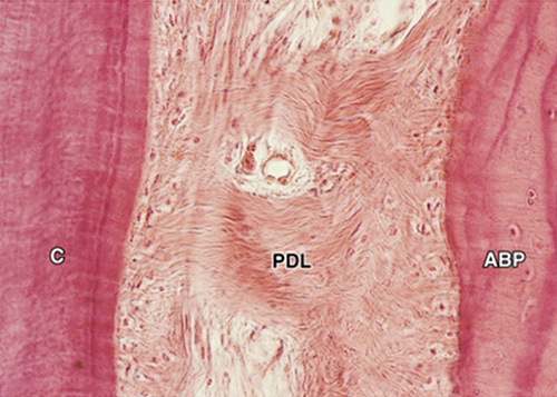 <p><span>Is a component of the periodontium; it is a layer of connective tissue between the bone and the cementum. It is less than 0.25mm in width (averaging 0.12-0.33 mm). It is hourglass in shape – widest at the coronal portion, narrowest in the middle and slightly wider at the apex.</span></p>