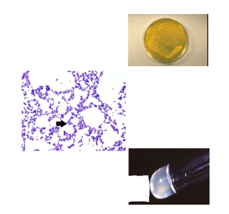 <p>What is the name of the pigment produced by this organism?</p>