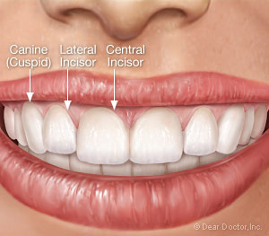 <p>The teeth next to the central incisors.</p>