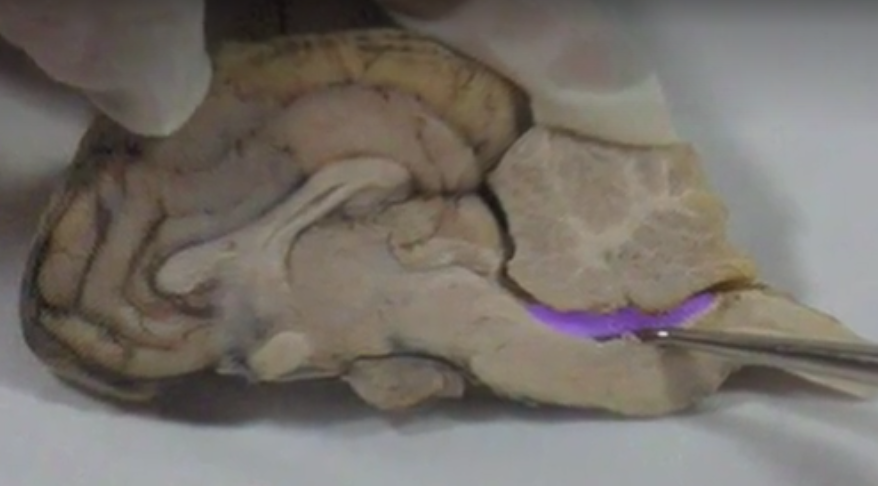 what is this part of the brain called