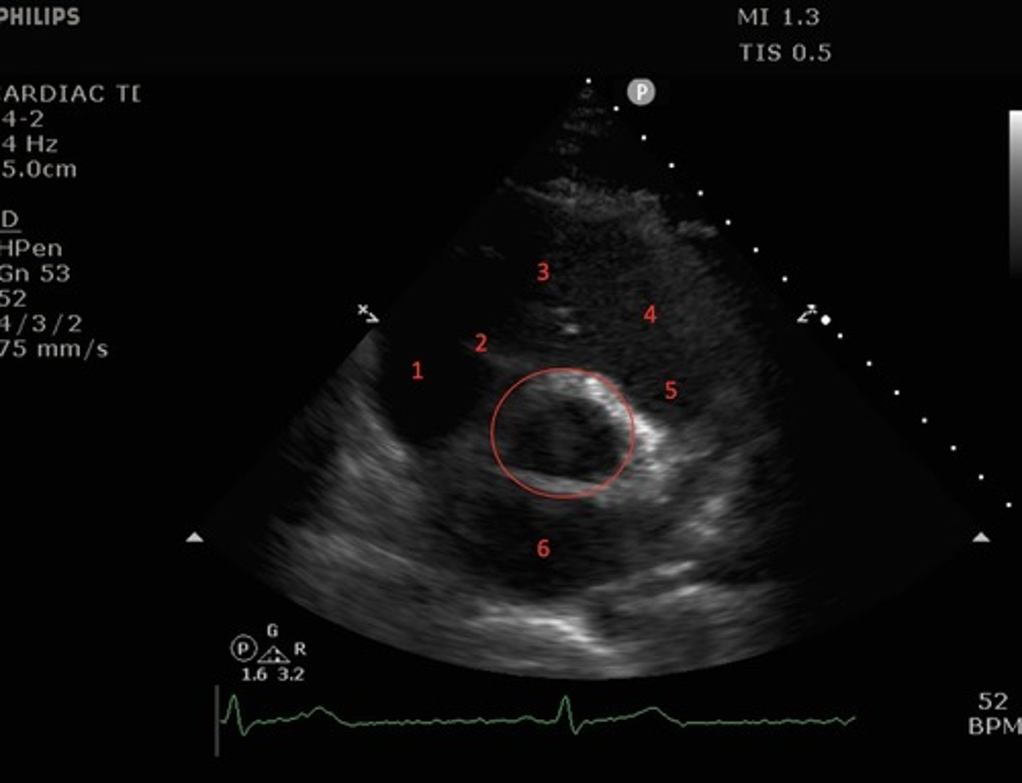 <p>identify the numbered and circled structures</p>
