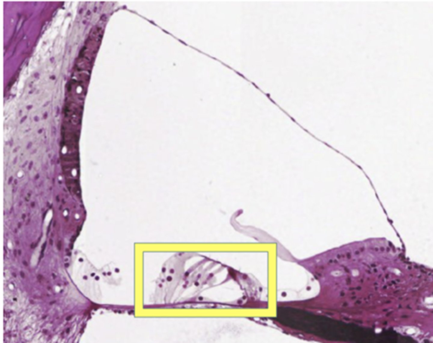 <p>Identify the structure</p>