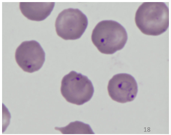 <p>which species of canine babesiosis is this?</p>