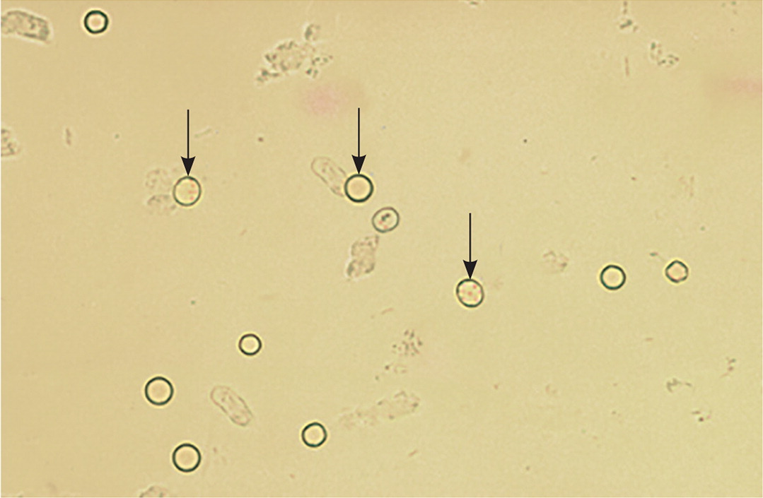 <p>What is the pointed cell primarily associated with?</p>