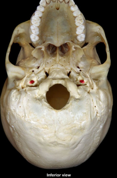 <p>(inferior view) round, hole, medial to styloid process</p>
