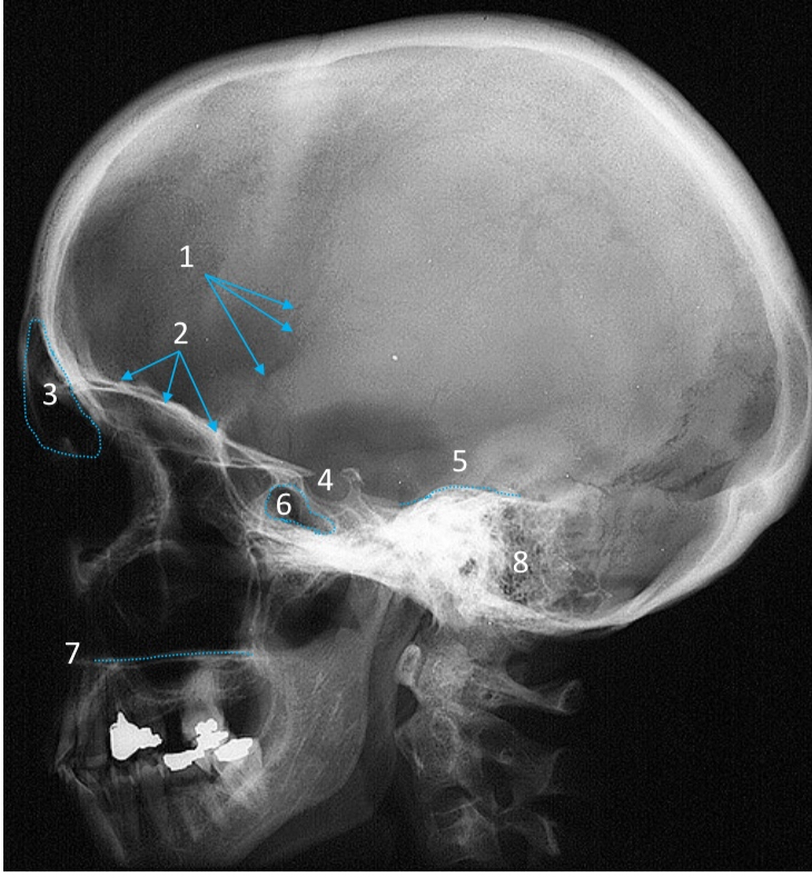 <ol start="3"><li><p>ID structure</p></li></ol><p></p>