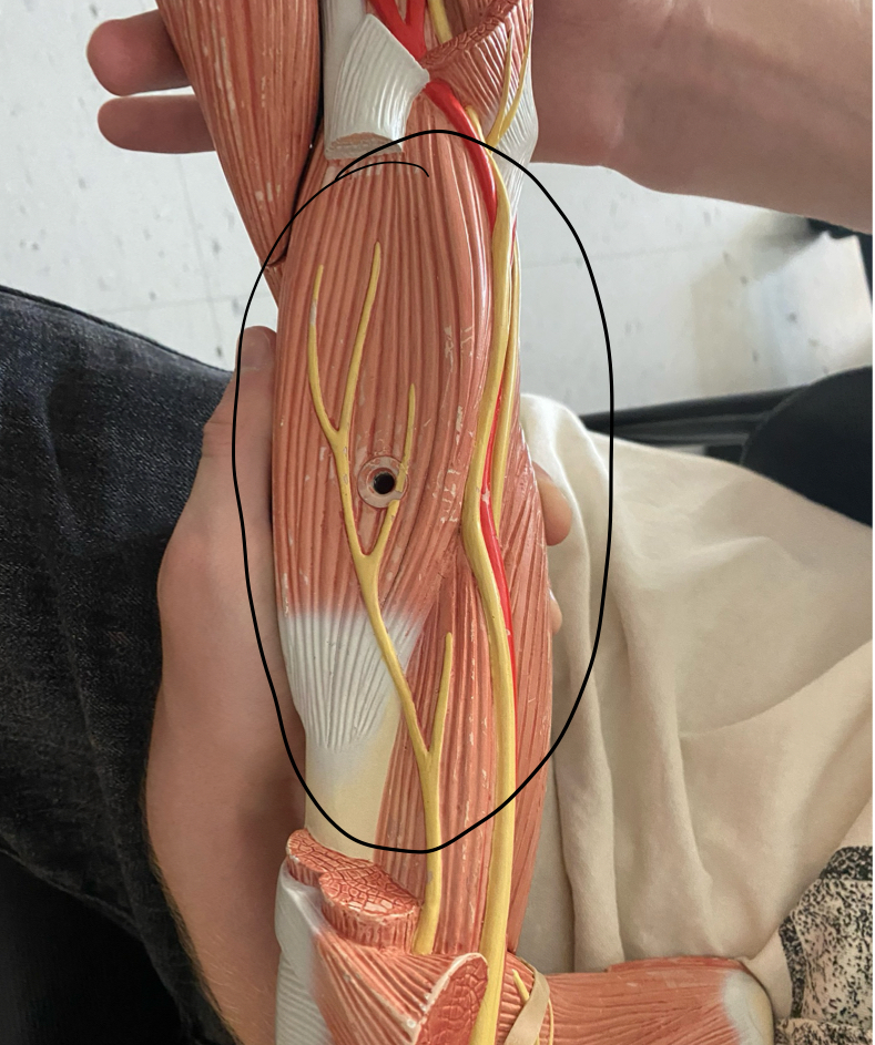 <p>Brachial Plexus 2</p>