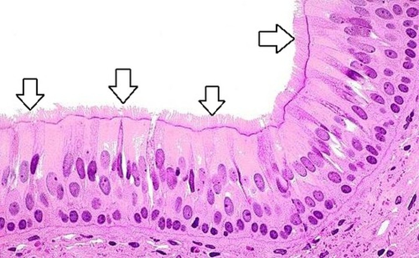 <p>Feature: Short &amp; many</p><p>Function: Stationary - have important function in sensory organs</p><p>Feature: Contain 2 central microtubules surrounded by 9 pairs of microtubules (9+2 wheel arrangement)</p><p>Function: Mobile - beat rhythmically (pairs of parallel microtubules slide over each other, cilia move)</p>