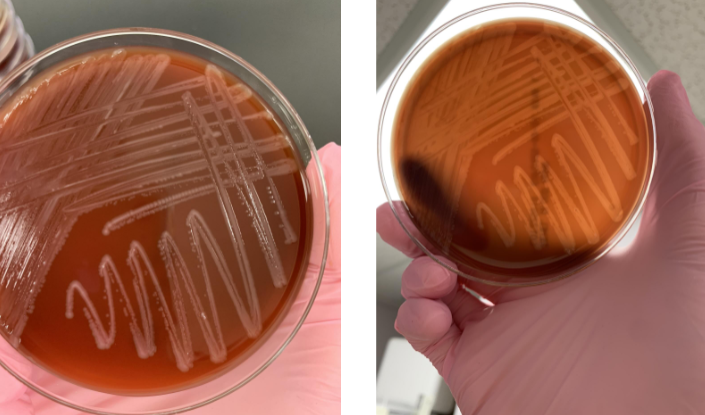 <p>lets say the gram stain showed GPB with beta from a blood culture and was catalase (+) what is most likely the organism</p>
