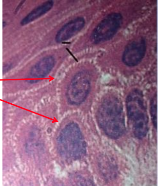 <p>¿Dónde encontramos desmosomas (uniones anclantes)?</p>