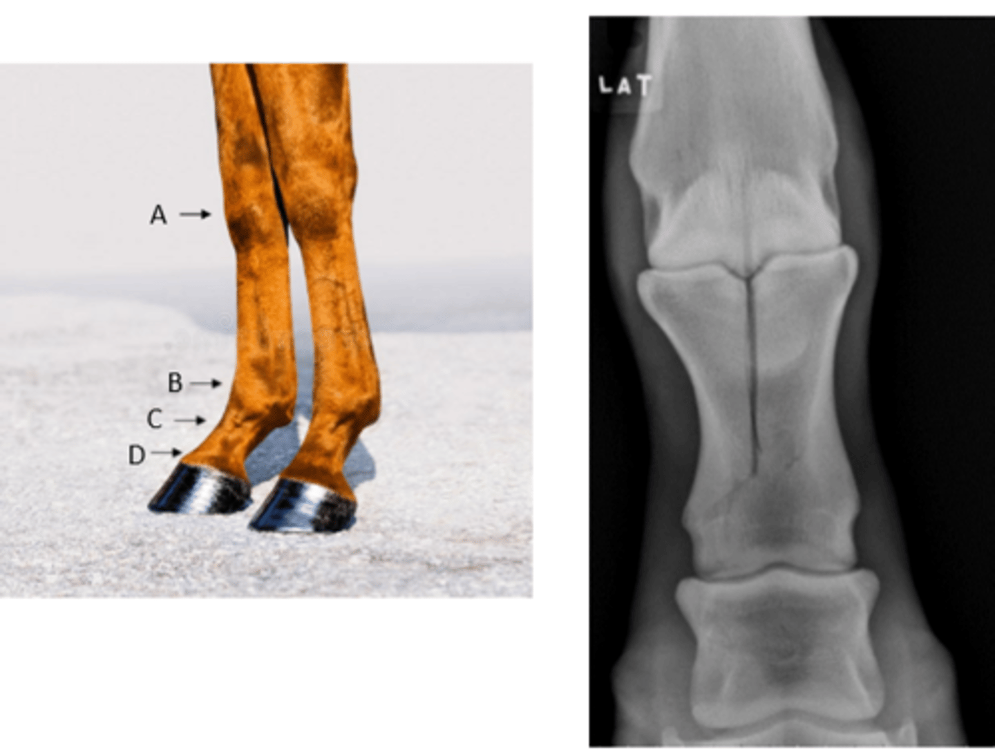 <p>What joint need to be stabilized?</p>