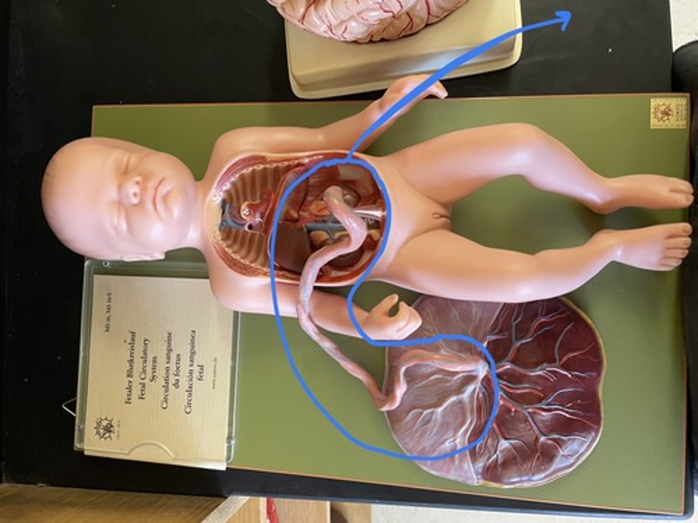 <p>a tube containing the blood vessels connecting the fetus and placenta</p>