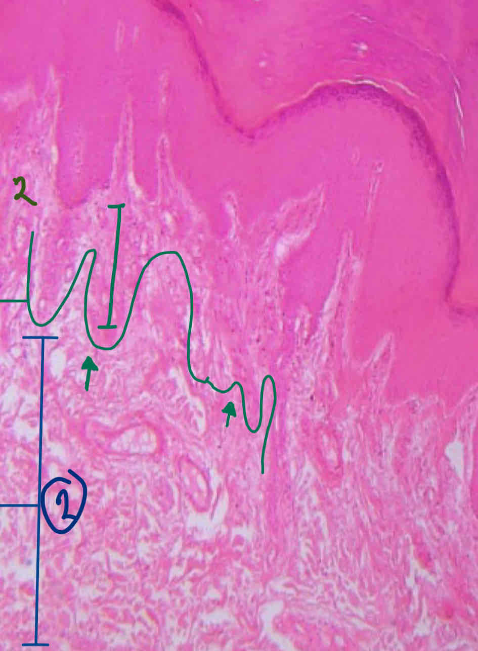 <p><strong>Layers of the Dermis</strong></p>