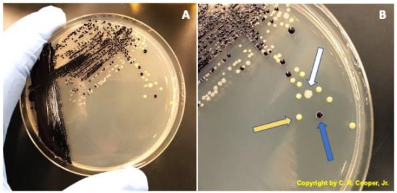 <ul><li><p><span>if original culture contained more than one bacterial species, colonies of each individual one can be <mark data-color="purple" style="background-color: purple; color: inherit">identified and removed</mark></span></p></li></ul>