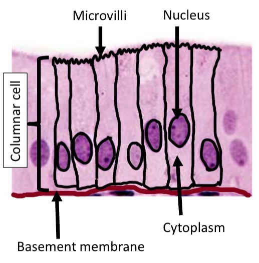 <ul><li><p>Columnar cell and goblet cell</p></li></ul><p></p>