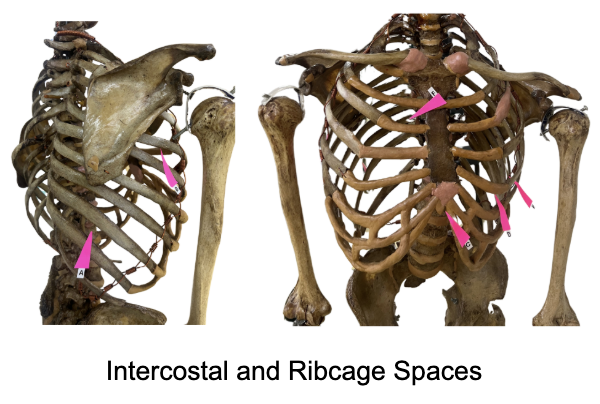 <p>Which amongst these is the: <span>5th ICS, Right Mid-Axillary Line</span></p>