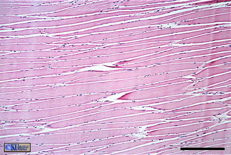 <p>Skeletal muscle</p>