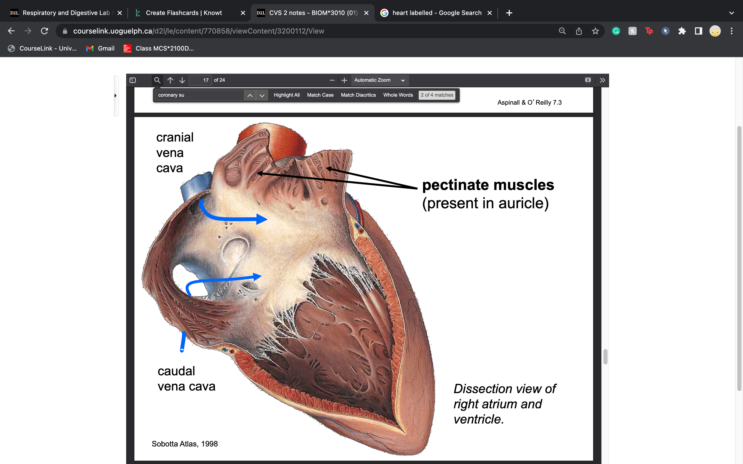 auricle of right atrium