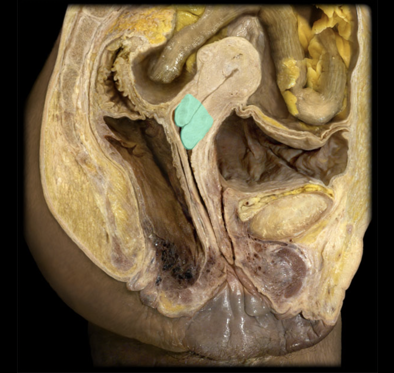 <p>What structure is shown?</p>