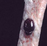 <p>Which neoplasia is seen as a red “raspberry” shaped mass? It is usually seen on the skin and has cavernous endothelial-lined spaces filled with blood within the tumor.</p>