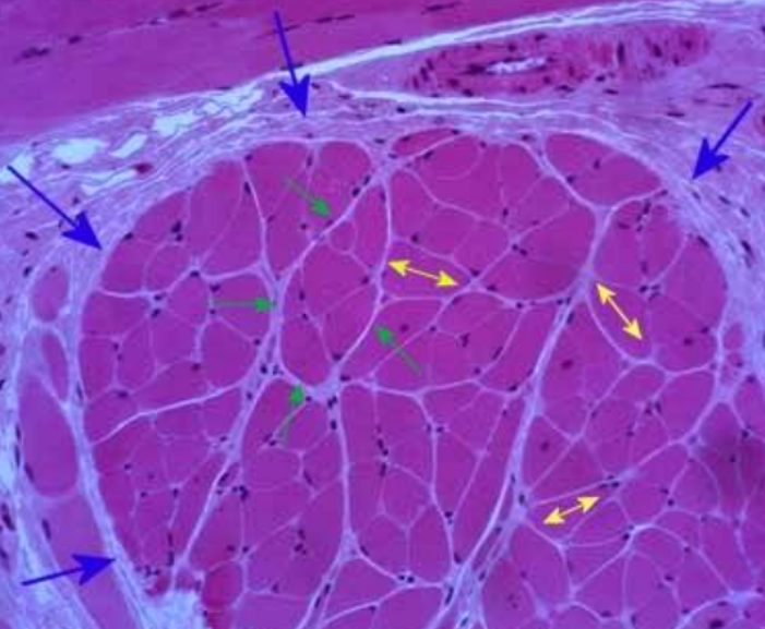 <p>What is the YELLOW arrows pointing to?</p>