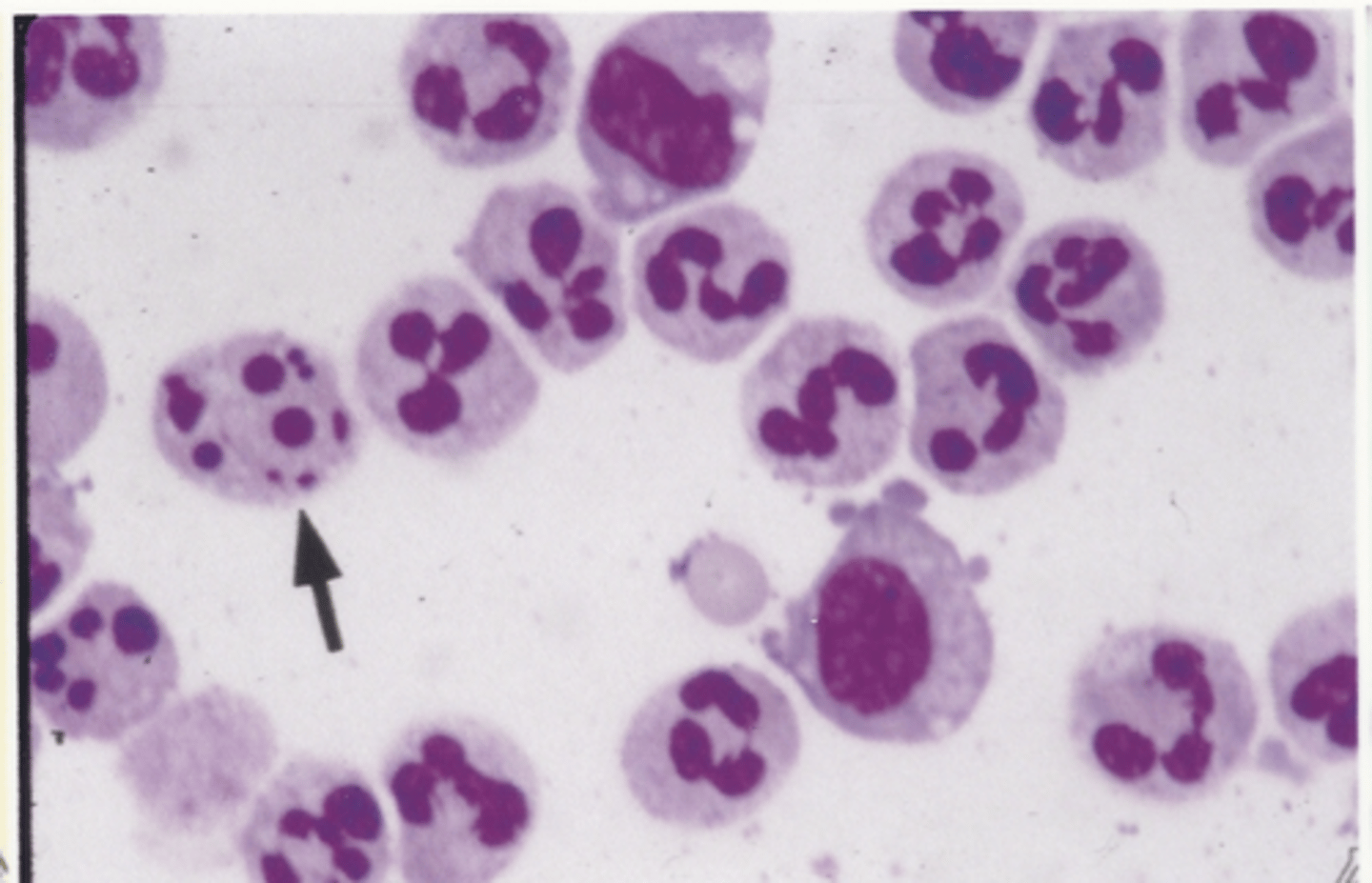 <p>Identify the cells in this body fluid</p>