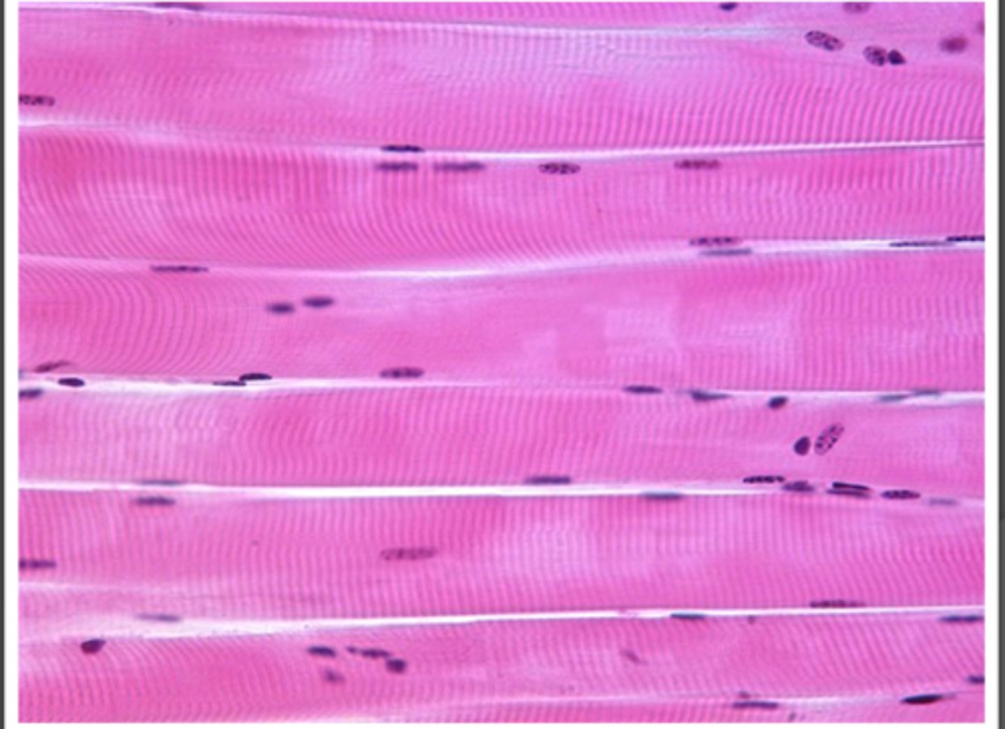 <p>1. Long cylindrical like cells (1cm length, diameter 50um)</p><p>2. Multinucleated, packed with myofibrils (1um dia)</p><p>1. Each myofibril contains contractile proteins</p><p>3. Usually each fiber has a single NM junction</p>