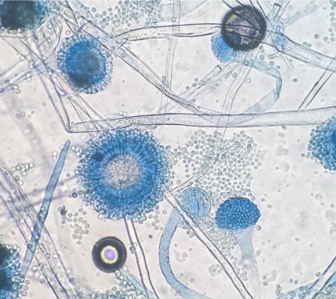 <p>Identify: Fungi</p>