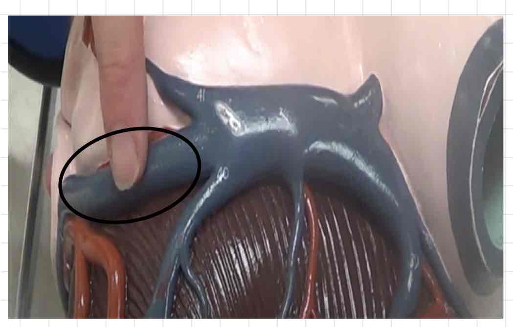 <p>what is this? (giant heart model)</p>