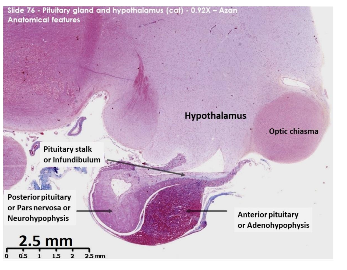 <ol><li><p>Nuclei - brilliant red </p></li><li><p>Collagen and reticulin – blue </p></li><li><p>Basophilic cytoplasm – blue/purple </p></li><li><p>Acidophilic cytoplasm – orange/red</p></li></ol><p></p><p>Identify:</p><ul><li><p>hypo</p></li><li><p>pit</p></li><li><p>optic chiasm→ mass of nerve fibres at the anterior limit of hypothalamus</p></li></ul><p></p>