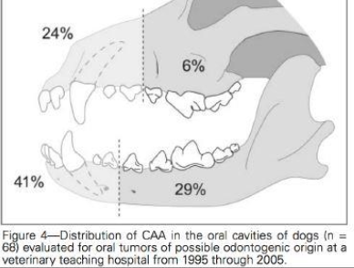 <p>Acanthomatous ameloblastoma </p>