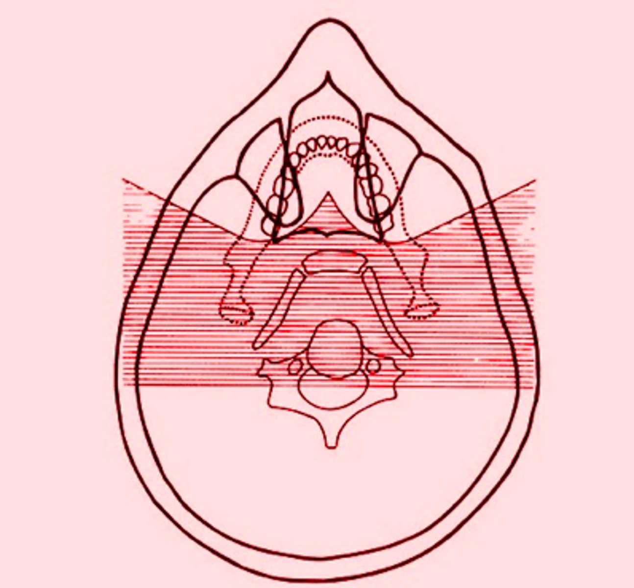 <p>the shaded regions will produce what type of images?</p>