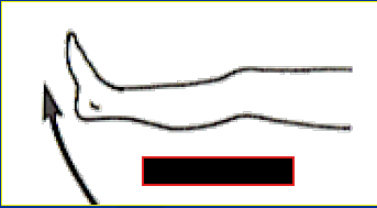 <p>What Movement is occurring?</p>
