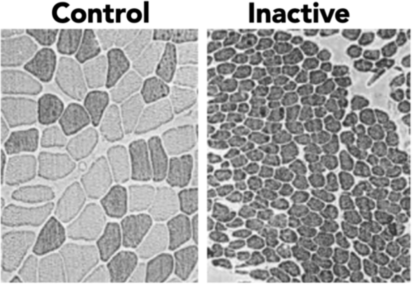 <p>- Reduction in size and number of myofibers</p><p>- Transition of muscle fibres from type I (slow) to type II (fast) myofibers</p>