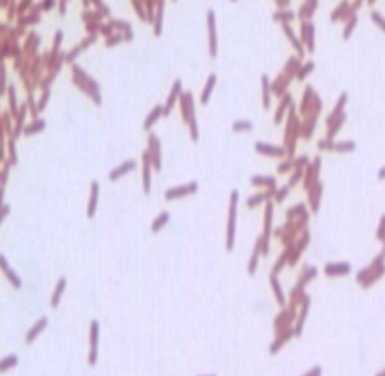 <p>negative</p>