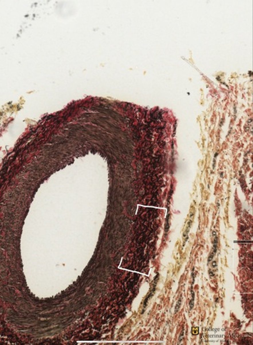 <p>What tissue type do the white brackets depict?</p><p>What structure is it surrounding?</p>