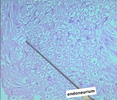 <p>Endoneurium</p>