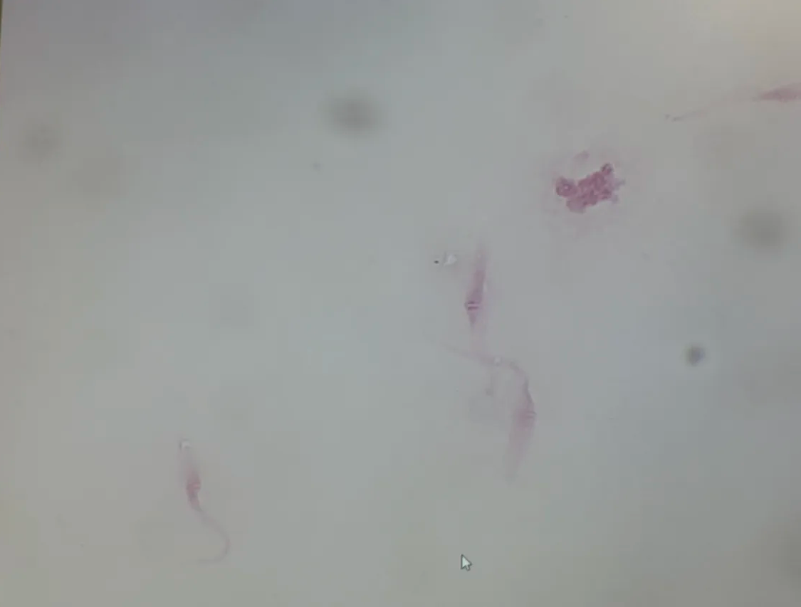 <p>in fly vector</p>